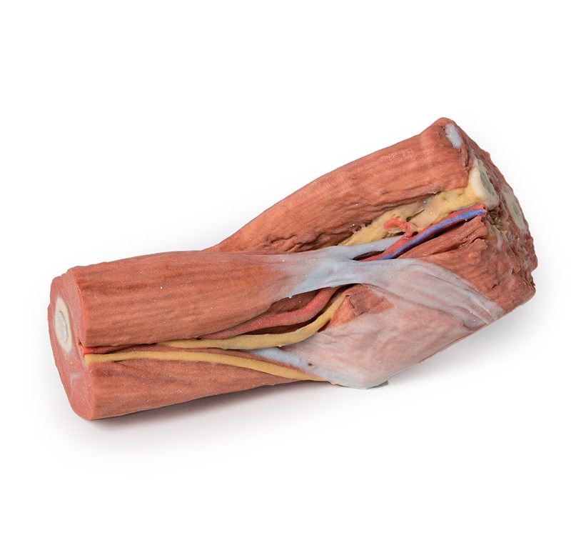 Fossa cubitalis – Muskeln, große Nerven und die Arteria brachialis