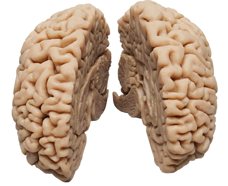 Menschliches Gehirn, Naturabguss