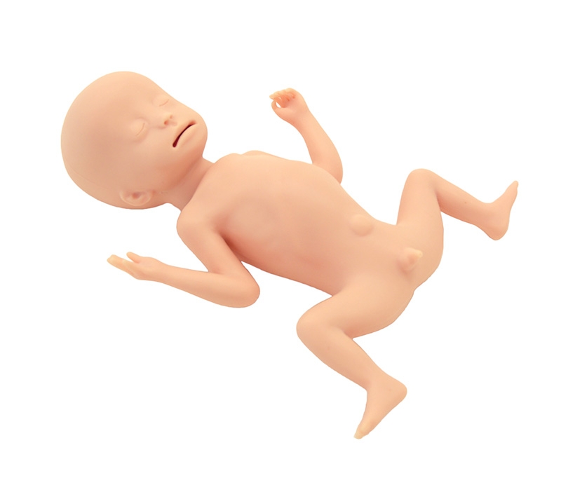 Frühgeborenes mit extrem niedrigem Geburtsgewicht (ELBW)