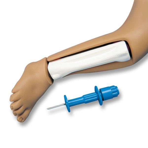 Erler-Zimmer Intraossäre Infusion für R17710 Erler-Zimmer Intraossäre Infusion für R17710