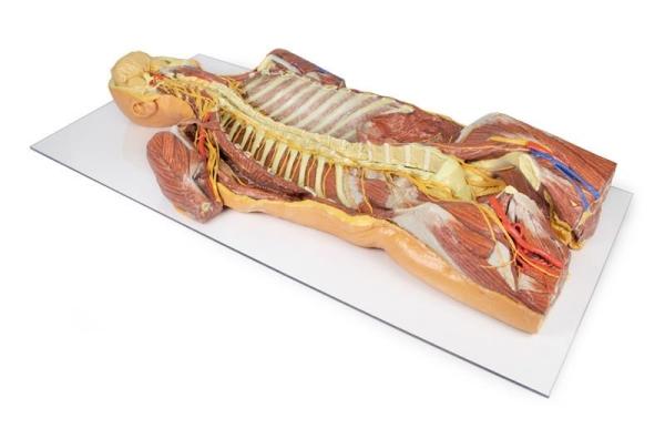 Erler-zimmer Posteriore Körperwand / ventrale tiefe Präparation