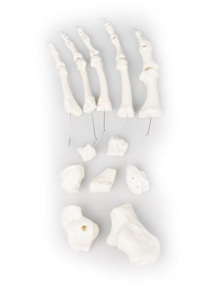 Erler-zimmer Fußknochen, unmontiert