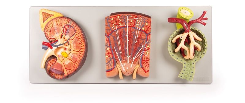 Nierenschnitt, Nephron und Nierenkörperchen